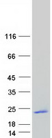 FGF1（NM_000800）Human Recombinant Protein人重組蛋白