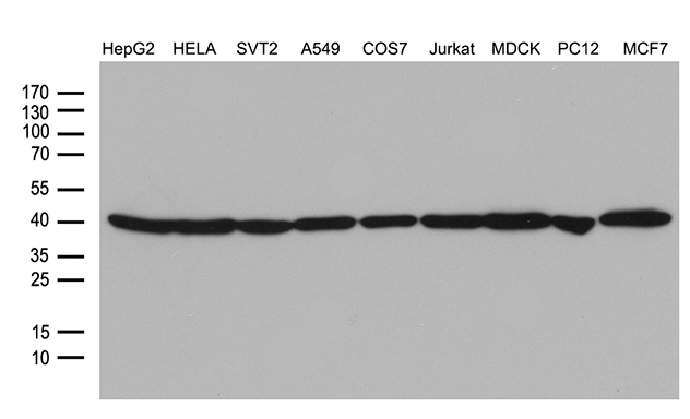 beta Actin (ACTB) Mouse Monoclonal Antibody